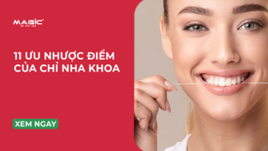 Minh họa 11 ưu nhược điểm của chỉ nha khoa