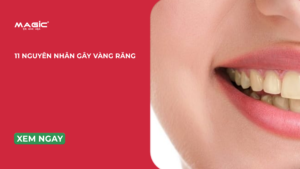 11 nguyên nhân gây ố vàng