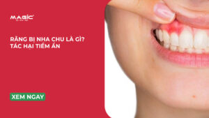 Minh họa nha chu là gì và tác hại tiềm ẩn