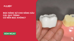Minh học bọc răng sứ cho răng sâu
