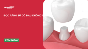 Minh họa bọc răng sứ có đau không?