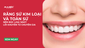 Minh họa bọc răng sứ kim loại và toàn sứ nên chọn loại nào