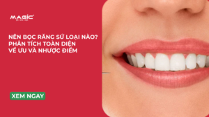 Minh họa nên bọc răng sứ loại nào