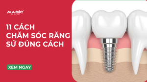 11 Cách Chăm Sóc Răng Sứ Đúng Cách Chuẩn Nha Khoa 10