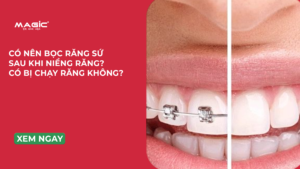Có Nên Bọc Răng Sứ Sau Khi Niềng Răng? Có Bị Chạy Răng Không?  2