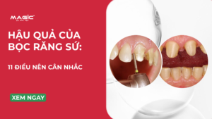 Hậu Quả Bọc Răng Sứ: 11 Điều Nên Cân Nhắc 11