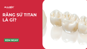 răng sứ titan là gì ?