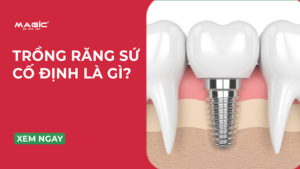 Từ A-Z Trồng Răng Sứ: Giải Đáp Về Quy Trình, Chi Phí 13