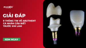 9 Thông Tin Về Abutment Cá Nhân Cần Biết Trước Khi Làm 7