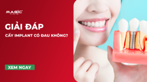 Cấy Implant Có Đau Không? Quá Trình Diễn Ra Như Thế Nào 1