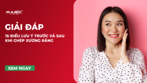 15 Điều Lưu Ý Trước Và Sau Khi Ghép Xương Răng 3