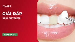 Răng Sứ Veneer Là Gì? Cấp Độ Mài Răng, Ưu Nhược Điểm 14