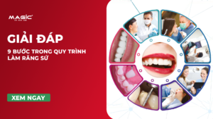 9 Bước Trong Quy Trình Làm Răng Sứ 5
