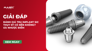 Đánh Giá Trụ Implant SIC Thụy Sỹ Có Bền Không? Ưu Nhược Điểm 8