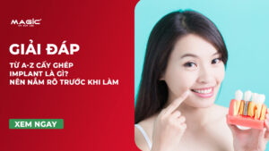 Từ A-Z Cấy Ghép Implant Là Gì? Nên Nắm Rõ Trước Khi Làm 9