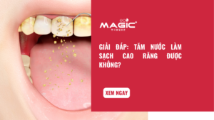 Giải Đáp: Tăm Nước Làm Sạch Cao Răng Được Không? 6