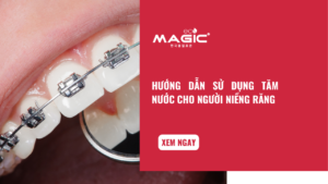 Hướng Dẫn Sử Dụng Tăm Nước Cho Người Niềng Răng 74